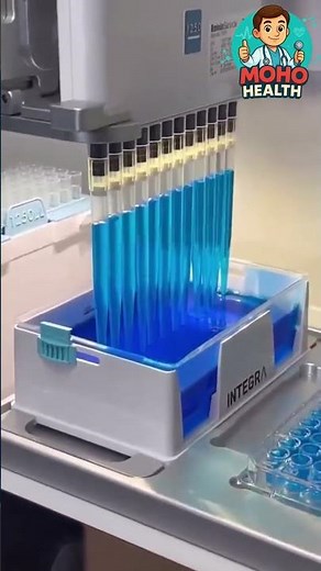 This Machine Does What Took Hours Before #Shorts #MedicalLab