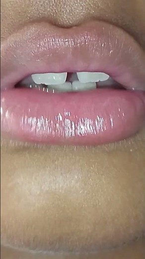 Woohoo #makeup #makeuptutorial #beauty #makeuplook #makeupartist