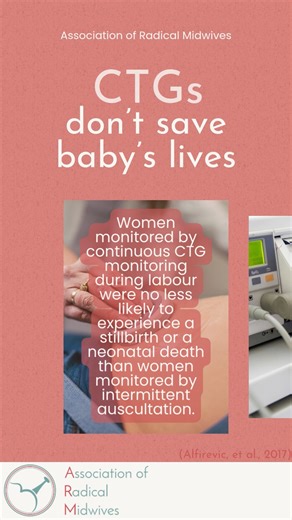 Discover the realities of continuous cardiotocography (CTG) in our latest reel! Despite 60 years of use, the effectiveness of CTG in fetal monitoring remains unproven. Join us as we explore the evidence and share insights on this important topic. Watch, learn, and share your knowledge with others! #Midwifery #CTG #EvidenceBasedPractice #radicalmidwives Alfirevic, Z., Devane, D., Gyte, G. M., & Cuthbert, A. (2017). Continuous cardiotocography (CTG) as a form of electronic fetal monitoring (EFM) f