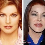 28 stars avant et après leur chirurgie esthétique - Page 2 sur 2