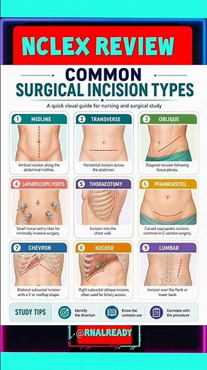 TYPES OF SURGICAL INCISIONS #Surgeon #Medicine#nursingstudent#usrn#nclexprep#incision #klimekreview