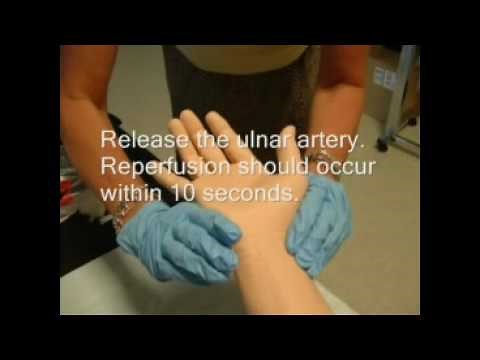 Arterial Blood Gas Sampling Procedure