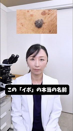 【皮膚科医が解説】この「イボ」の本当の名前