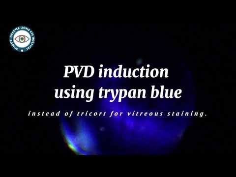 PVD induction using trypan blue