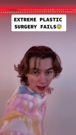 Extreme Plastic Surgery Fails: The Shocking Transformation of the Bogdanoff Twins