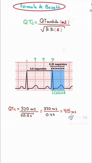 Intervalo QT Corregido: Cálculo y Valores Normales