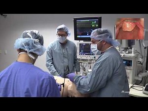 KP OR Checklist - Difficult Airway - 2