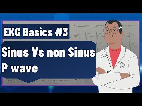 ECG basics | how to identify sinus P wave on ECG | ECG findings and examples