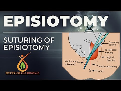 Episiotomy || Types|| Articles || Procedure ‪@ritikasnursingtutorials‬
