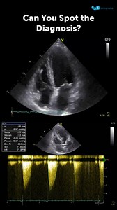 271K views · 730 reactions | Can You Spot the Diagnosis?  A...