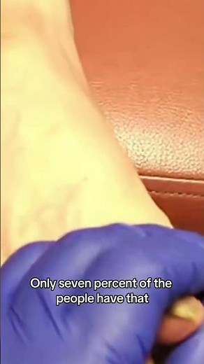 The Stroke That Leaves You Awake But Unable to Move