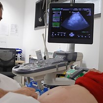 Video: Versión cefálica externa: ¿Es un procedimiento eficaz y seguro?