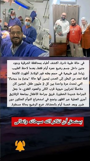 رضيع في الشرقية يولد وبداخله جنين… جراحة نادرة تنقذ حياته