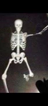 "AHHHHH THE BACTERIA IS GETTING POSSESED" Meme compilation