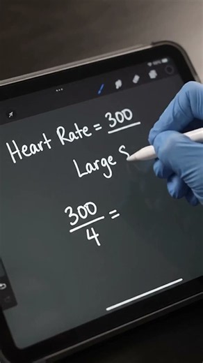 How to Calculate Heart Rate | ECG Interpretation