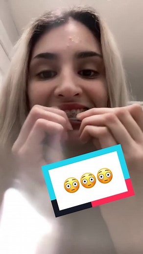 #stitch with @dfigsx DONT let your teeth MOVE! Go get a retainer ASAP homie! 😬 #braces #invisalign #health #teeth #react #reaction