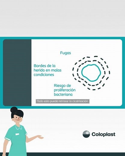 Tratar las heridas no es sencillo: apósitos de espuma con Tecnología 3DFit de Coloplast