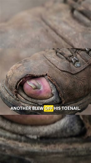 He Survived Lightning 7 times 😱