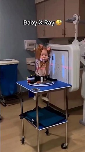 BABY X-Ray 🤣