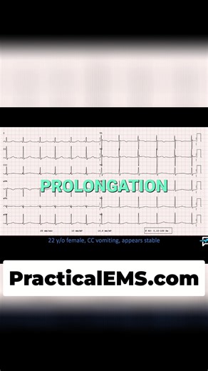 When a patient presents with vomiting and sinus tachycardia, an EKG helps assess for QT prolongation or electrolyte abnormalities. The treatment depends on the underlying cause, like anxiety or sepsis. Is it cardiac tamponade? Rule it out first. #SinusTachycardia #Vomiting #EKG #ElectrolyteImbalance #Cardiac | Practical EMS