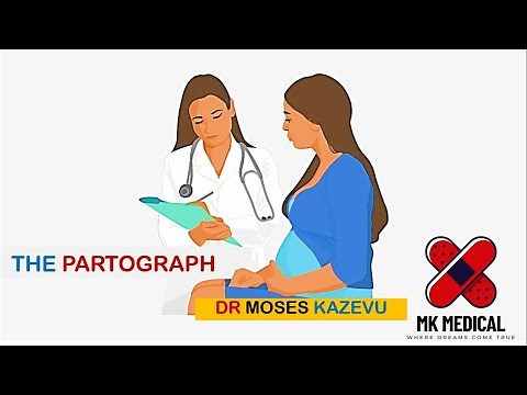 Partograph || How to plot a partograph