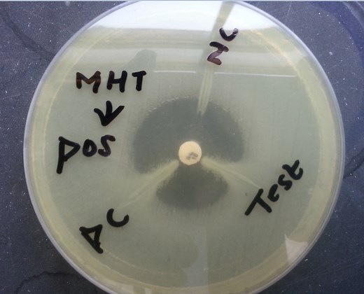 Hodge Test Positive :Principle, procedure and result Interpretations