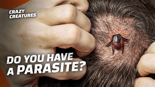 Parasites Explained: Creepy, Clever, and Everywhere
