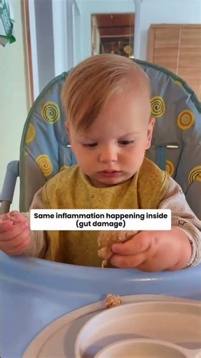 Are rosy cheeks after meals actually a warning sign?