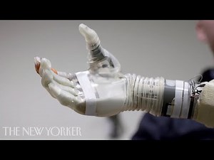 A Robotic Arm Controlled by the Mind | The New Yorker