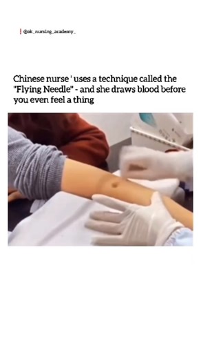 Ak Nursing Academy | "Flying needle" refers to a rapid, precise blood draw technique used by skilled phlebotomists, often in China, making it seem effortless... | Instagram