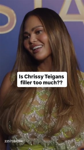 Advanced Aesthetic Pharmacist | Aesthetics Trainer on Instagram: "Has Chrissy Teigan gone too far with her filler?? 💉 #chrissyteigan #londoninjector #celebtransformation"