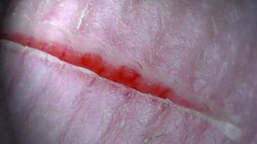 人体受伤后伤口该怎么愈合？3D动画演示全程，看完大开眼界！