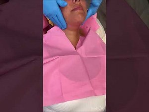 Double chin with Lemon Bottle