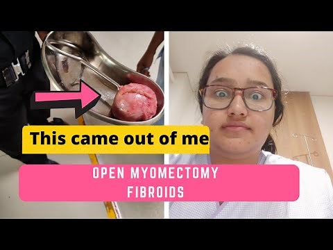 The Fibroid Journey: Open Myomectomy
