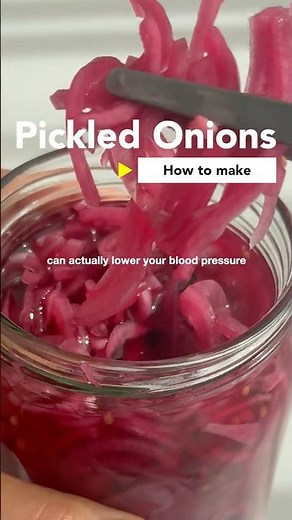 The Easiest Pickled Onions You’ll Ever Make