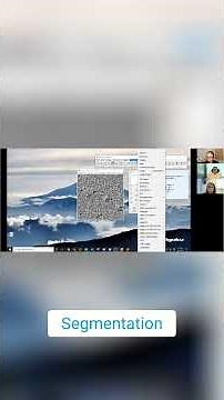 Weka Segmentation Training Your 3D CT Scan