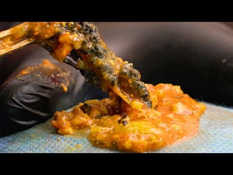 Dr. Lee 🌝 Some Real Tough Comedones 🌝 Geoff Butler Enilsa MrPopZit 🌝 Dr. Pimple Popper 🌝 D261206