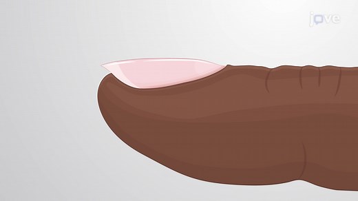 Video: Accessory Structures of the Skin: Nails