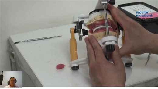 【全口义齿】BPS临床实操案例系列课