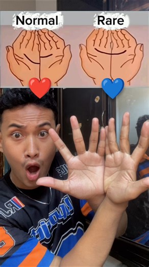 Normal or Rare? #trending #challenge #shorts #fypシ #viralvideo