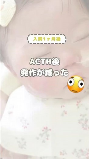 ACTH後発作が減った…？｜付き添い入院1ヶ月 #難治性てんかん #ウエスト症候群