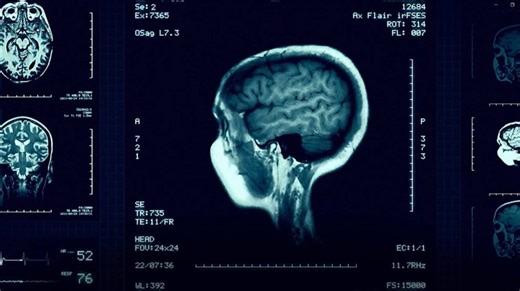 As células do cérebro, um universo à parte - RTP Ensina