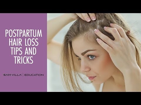 Postpartum Hair Loss Tips and Tricks