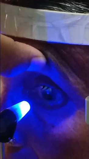 Goldmann applanation tonometry