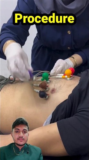 electro cardio graphy #ecg #electrocardiogram #electrocardiogram #ecgtest