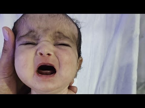 Premature Baby Fighting Meningitis & Sepsis | NICU Critical Condition Journey"