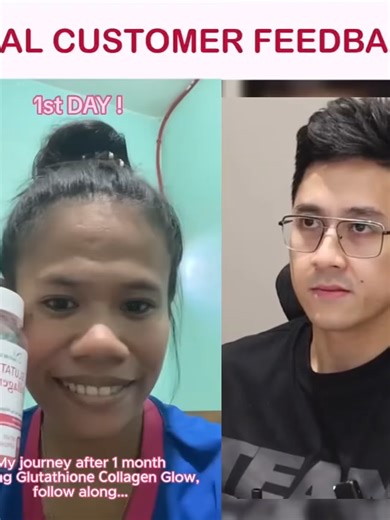 💖 Imagine looking in the mirror and seeing brighter, firmer, flawless skin – without filters or expensive treatments. With just two gummies a day, your dream skin is closer than ever! #glutathionegummies #gummies #skincare