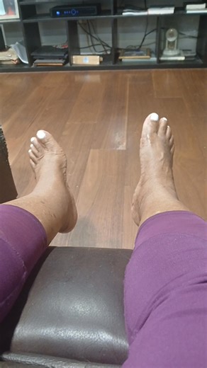 My feet feel and look like a million bucks no more pain no more swelling | Debra Thomas | Facebook