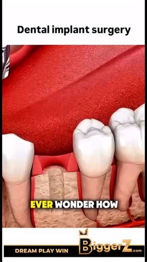 Animations on Instagram: "Follow @surgicalanimation for more! 🏥 #biggerz @biggerz"