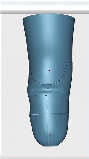 From Scan to socket: 4 Steps to 3D Print a custom prosthesis! 🦾
